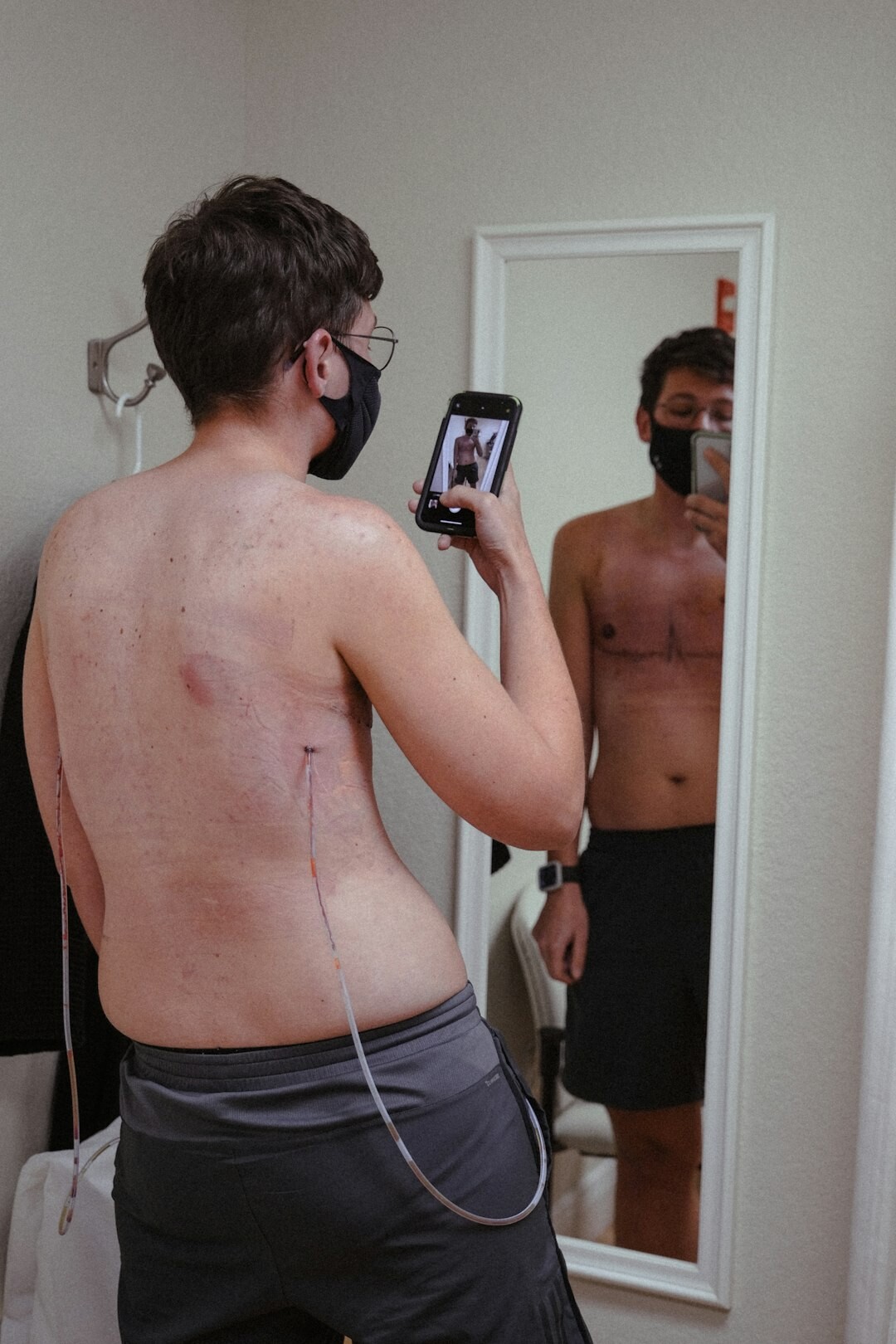singer physical transformation before after